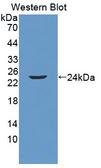 LCN2 / Lipocalin 2 / NGAL Antibody - Western blot of LCN2 / Lipocalin 2 / NGAL antibody.