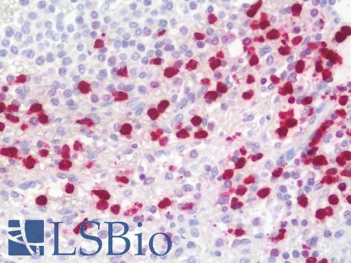 LCN2 / Lipocalin 2 / NGAL Antibody - Anti-LCN2 / Lipocalin 2 / NGAL antibody IHC staining of human spleen. Immunohistochemistry of formalin-fixed, paraffin-embedded tissue after heat-induced antigen retrieval. Antibody concentration 10 ug/ml.  This image was taken for the unconjugated form of this product. Other forms have not been tested.