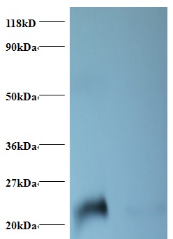 LCN2 / Lipocalin 2 / NGAL Antibody - Western blot of NGAL Antibody at 2 ug/ml + positive serum. Lane 1: positive serum at 1:10. Lane 2: positive serum at 1:50. Secondary: Goat polyclonal to Rabbit IgG at 1:15000 dilution. Predicted band size: 22 kDa. Observed band size: 22 kDa.  This image was taken for the unconjugated form of this product. Other forms have not been tested.