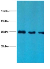 LCN2 / Lipocalin 2 / NGAL Antibody - Western blot of NGAL antibody.  Lane 1: positive serum at 1:10.  Lane 2: positive serum at 1:100.  Lane 3: positive serum at 1 : 500.  Secondary used is a Goat polyclonal to Rabbit IgG at 1:15000 dilution.  This image was taken for the unconjugated form of this product. Other forms have not been tested.