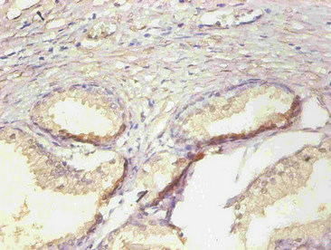 LCN2 / Lipocalin 2 / NGAL Antibody - Immunohistochemical of paraffin-embedded human prostate tissue using LCN2 Monoclonal Antibody at dilution of 1:200