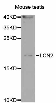 LCN2 / Lipocalin 2 / NGAL Antibody - Western blot analysis of extracts of Mouse testis cells.