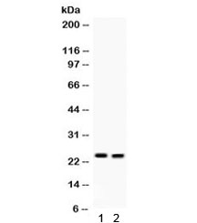 LCN2 / Lipocalin 2 / NGAL Antibody