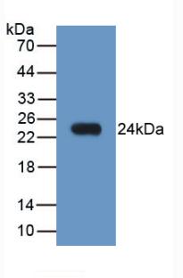 LCN2 / Lipocalin 2 / NGAL Antibody - Western Blot; Sample: Recombinant NGAL, Human.