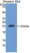 LCN2 / Lipocalin 2 / NGAL Antibody - Western Blot; Sample: Recombinant NGAL, Rat.