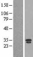 LCN2 / Lipocalin 2 / NGAL Protein - Western validation with an anti-DDK antibody * L: Control HEK293 lysate R: Over-expression lysate