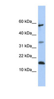 LCN6 Antibody - LCN6 antibody Western blot of 721_B cell lysate. This image was taken for the unconjugated form of this product. Other forms have not been tested.