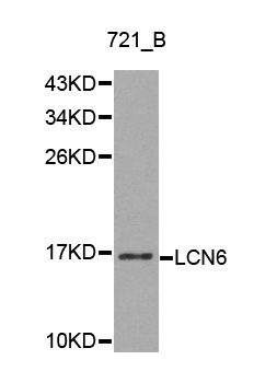 LCN6 Antibody - Western blot analysis of 721_B cell lysate using LCN6 antibody.
