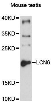 LCN6 Antibody - Western blot analysis of extracts of mouse testis, using LCN6 antibody at 1:1000 dilution. The secondary antibody used was an HRP Goat Anti-Rabbit IgG (H+L) at 1:10000 dilution. Lysates were loaded 25ug per lane and 3% nonfat dry milk in TBST was used for blocking. An ECL Kit was used for detection and the exposure time was 5s.