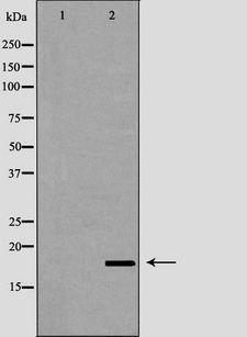 LCN6 Antibody - Western blot analysis of 721_B lysate using LCN6 antibody. The lane on the left is treated with the antigen-specific peptide.