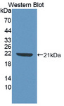 LCN8 Antibody - Western blot of LCN8 antibody.