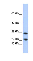 LCN8 Antibody - LCN8 antibody Western blot of 721_B cell lysate. This image was taken for the unconjugated form of this product. Other forms have not been tested.