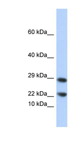 LCN8 Antibody - LCN8 antibody Western blot of 721_B cell lysate. This image was taken for the unconjugated form of this product. Other forms have not been tested.