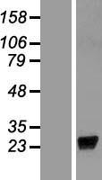 LCN9 Protein - Western validation with an anti-DDK antibody * L: Control HEK293 lysate R: Over-expression lysate