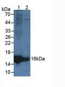 LCNL1 Antibody - Western Blot; Sample: Lane1: Rat Ovary Tissue; Lane2: Human Hela Cells.