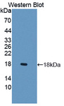 LCNL1 Antibody - Western blot of LCNL1 antibody.