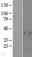 LCORL Protein - Western validation with an anti-DDK antibody * L: Control HEK293 lysate R: Over-expression lysate