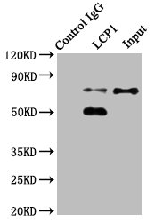 LCP1 / L-Plastin Antibody - Immunoprecipitating LCP1 in Jurkat whole cell lysate Lane 1: Rabbit control IgG instead of LCP1 Antibody in Jurkat whole cell lysate.For western blotting, a HRP-conjugated Protein G antibody was used as the secondary antibody (1/2000) Lane 2: LCP1 Antibody (8µg) + Jurkat whole cell lysate (500µg) Lane 3: Jurkat whole cell lysate (20µg)