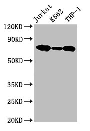 LCP1 / L-Plastin Antibody - Western blot All lanes: Plastin-2 antibody at 2µg/ml Lane 1: HL60 whole cell lysate Lane 2: THP-1 whole cell lysate Lane 3: K562 whole cell lysate Lane 4: Jurkat whole cell lysate Lane 5: Hela whole cell lysate Lane 6: NIH/3T3 whole cell lysate Secondary Goat polyclonal to rabbit IgG at 1/10000 dilution Predicted band size: 71, 22 kDa Observed band size: 71 kDa