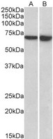 LCP1 / L-Plastin Antibody - Goat anti-LCP1 / plastin-2 (aa277-291) Antibody (0.5µg/ml) staining of Daudi (A) and U937 (B) lysates (35µg protein in RIPA buffer). Primary incubation was 1 hour. Detected by chemiluminescencence.
