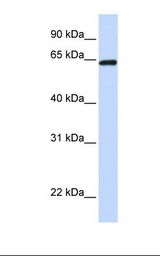 LCP1 / L-Plastin Antibody - Placenta lysate. Antibody concentration: 1.0 ug/ml. Gel concentration: 12%.  This image was taken for the unconjugated form of this product. Other forms have not been tested.