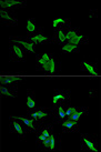 LCP1 / L-Plastin Antibody - Immunofluorescence analysis of HeLa cells.