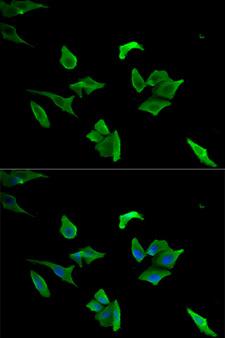 LCP1 / L-Plastin Antibody - Immunofluorescence analysis of HeLa cells.