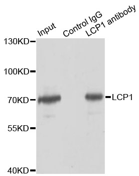 LCP1 / L-Plastin Antibody - Immunoprecipitation analysis of 150ug extracts of Jurkat cells.