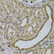 LCP1 / L-Plastin Antibody - Immunohistochemistry of paraffin-embedded human kidney using LCP1 Antibody at dilution of 1:100 (40x lens).