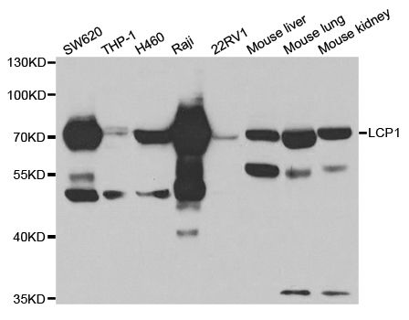 LCP1 / L-Plastin Antibody - Western blot analysis of extracts of various cell lines, using LCP1 antibody at 1:1000 dilution. The secondary antibody used was an HRP Goat Anti-Rabbit IgG (H+L) at 1:10000 dilution. Lysates were loaded 25ug per lane and 3% nonfat dry milk in TBST was used for blocking. An ECL Kit was used for detection and the exposure time was 5s.