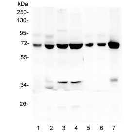 LCP1 / L-Plastin Antibody - Western blot testing of human 1) CCRF-CEM, 2) HEK293, 3) HL-60, 4) THP-1, 5) rat spleen, 6) mouse spleen and 7) mouse RAW246 lysate with L Plastin antibody at 0.5ug/ml. Predicted molecular weight ~70 kDa.