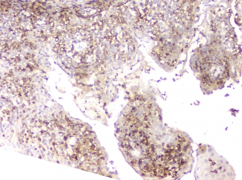 LCP1 / L-Plastin Antibody - IHC staining of FFPE human tonsil with L Plastin antibody at 1ug/ml. HIER: boil tissue sections in pH6, 10mM citrate buffer, for 10-20 min and allow to cool before testing.