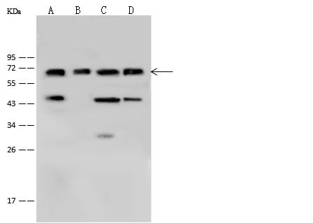 LCP1 / L-Plastin Antibody - Anti-LCP1 rabbit polyclonal antibody at 1:500 dilution. Lane A: THP1 Whole Cell Lysate. Lane B: K562 Whole Cell Lysate. Lane C: Jurkat Whole Cell Lysate. Lane D: Daudi Whole Cell Lysate. Lysates/proteins at 30 ug per lane. Secondary: Goat Anti-Rabbit IgG (H+L)/HRP at 1/10000 dilution. Developed using the ECL technique. Performed under reducing conditions. Predicted band size: 70 kDa. Observed band size: 70 kDa.