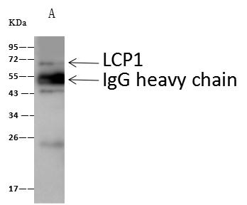 LCP1 / L-Plastin Antibody - Nkx1-2 was immunoprecipitated using: Lane A: 0.5 mg mouse lung tissue lysate. 4 uL anti-Nkx1-2 rabbit polyclonal antibody and 60 ug of Immunomagnetic beads Protein A/G. Primary antibody: Anti-Nkx1-2 rabbit polyclonal antibody, at 1:100 dilution. Secondary antibody: Goat Anti-Rabbit IgG (H+L)/HRP at 1/10000 dilution. Developed using the ECL technique. Performed under reducing conditions. Predicted band size: 32 kDa. Observed band size: 30 kDa.