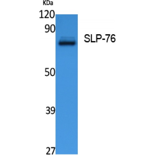 LCP2 / SLP-76 Antibody - Western blot of SLP-76 antibody