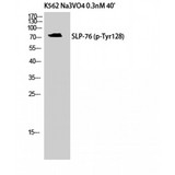 LCP2 / SLP-76 Antibody - Western blot of Phospho-SLP-76 (Y128) antibody
