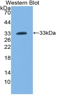 LCP2 / SLP-76 Antibody - Western blot of recombinant LCP2 / SLP-76.