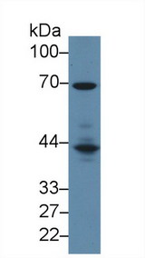 LCP2 / SLP-76 Antibody - Western Blot; Sample: Mouse Spleen lysate; Primary Ab: 2µg/ml Rabbit Anti-Mouse LCP2 Antibody Second Ab: 0.2µg/mL HRP-Linked Caprine Anti-Rabbit IgG Polyclonal Antibody