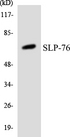 LCP2 / SLP-76 Antibody - Western blot analysis of the lysates from HT-29 cells using SLP-76 antibody.