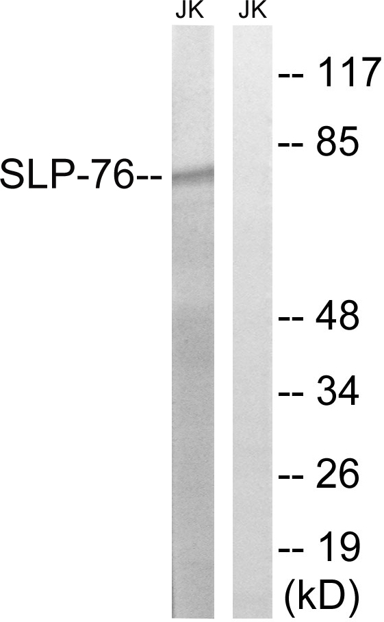 LCP2 / SLP-76 Antibody - Western blot analysis of lysates from Jurkat cells, treated with EGF 200ng/ml 5', using SLP-76 Antibody. The lane on the right is blocked with the synthesized peptide.