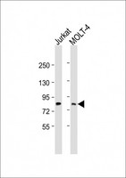 LCP2 / SLP-76 Antibody - All lanes: Anti-LCP2 Antibody (Center) at 1:2000 dilution Lane 1: Jurkat whole cell lysate Lane 2: MOLT-4 whole cell lysate Lysates/proteins at 20 µg per lane. Secondary Goat Anti-Rabbit IgG, (H+L), Peroxidase conjugated at 1/10000 dilution. Predicted band size: 60 kDa Blocking/Dilution buffer: 5% NFDM/TBST.