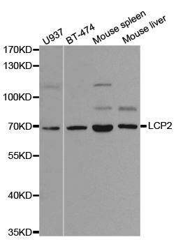 LCP2 / SLP-76 Antibody - Western blot analysis of extracts of various cell lines.