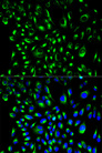 LCP2 / SLP-76 Antibody - Immunofluorescence analysis of HeLa cells.