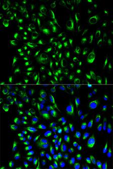 LCP2 / SLP-76 Antibody - Immunofluorescence analysis of HeLa cells.