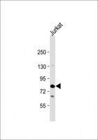 LCP2 / SLP-76 Antibody - Anti-LCP2 Antibody (N-Term) at 1:2000 dilution + Jurkat whole cell lysate Lysates/proteins at 20 µg per lane. Secondary Goat Anti-Rabbit IgG, (H+L), Peroxidase conjugated at 1/10000 dilution. Predicted band size: 60 kDa Blocking/Dilution buffer: 5% NFDM/TBST.