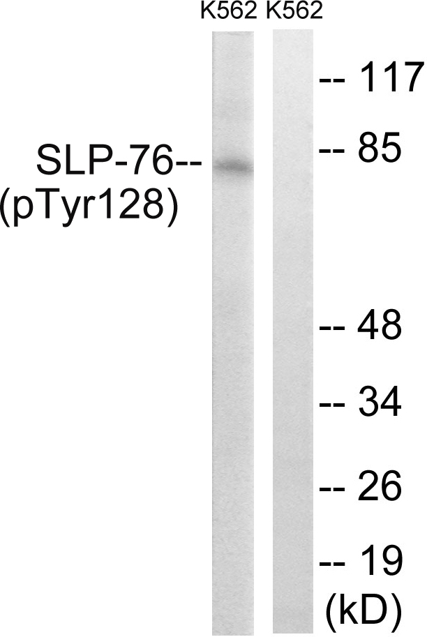 LCP2 / SLP-76 Antibody - Western blot analysis of lysates from K562 cells treated with Na3VO4 0.3nM 40', using SLP-76 (Phospho-Tyr128) Antibody. The lane on the right is blocked with the phospho peptide.