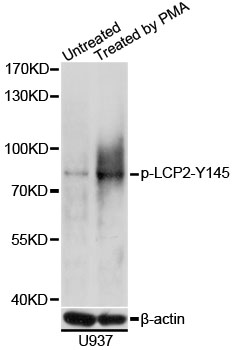 LCP2 / SLP-76 Antibody - Western blot analysis of extracts of U937 cells, using Phospho-LCP2-Y145 antibody at 1:1000 dilution. U-937 cells were treated by PMA/TPA (200nM) for 30 minutes. The secondary antibody used was an HRP Goat Anti-Rabbit IgG (H+L) at 1:10000 dilution. Lysates were loaded 25ug per lane and 3% nonfat dry milk in TBST was used for blocking. Blocking buffer: 3% BSA.An ECL Kit was used for detection and the exposure time was 10s.