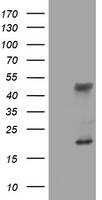 LCX / TET1 Antibody - HEK293T cells were transfected with the pCMV6-ENTRY control (Left lane) or pCMV6-ENTRY TET1 (Right lane) cDNA for 48 hrs and lysed. Equivalent amounts of cell lysates (5 ug per lane) were separated by SDS-PAGE and immunoblotted with anti-TET1.