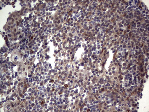 LCX / TET1 Antibody - IHC of paraffin-embedded Human tonsil using anti-TET1 mouse monoclonal antibody. (Heat-induced epitope retrieval by 1 mM EDTA in 10mM Tris, pH8.5, 120°C for 3min).