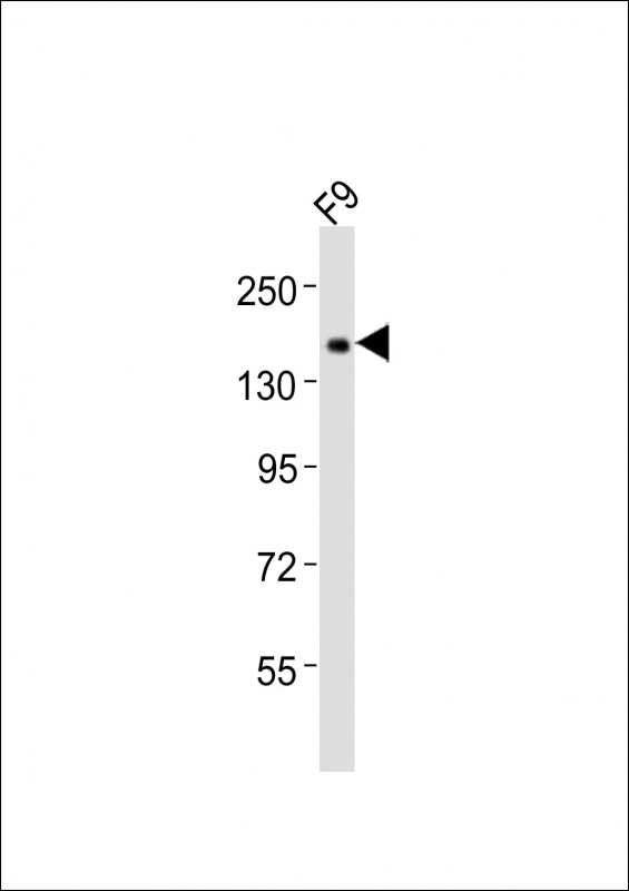 LCX / TET1 Antibody - Anti-Tet1 Antibody at 1:2000 dilution + F9 whole cell lysates Lysates/proteins at 20 ug per lane. Secondary Goat Anti-Rabbit IgG, (H+L), Peroxidase conjugated at 1/10000 dilution Predicted band size : 219 kDa Blocking/Dilution buffer: 5% NFDM/TBST.
